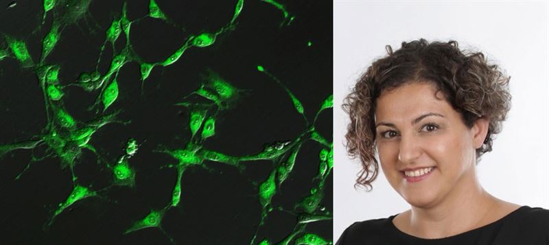 Almi Invest investerar i cancerdiagnostik-bolaget Celluminova som kan öka överlevnadsgraden vid hjärnkirurgi acbdda3a4918af41 800x800ar